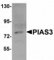 PIAS3 Antibody (C-Terminus)